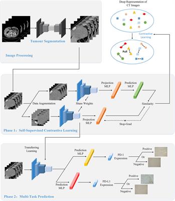 Self-supervised contrastive learning using CT images for PD-1/PD-L1 expression prediction in hepatocellular carcinoma